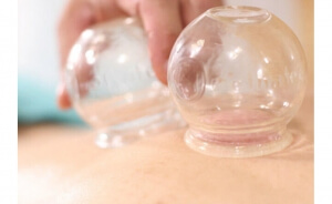 Akupunktur Mantığı ile Kupaterapi Eğitimi